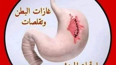أعراض القولون العصبي وجرثومة المعدة وطرق علاجهما
