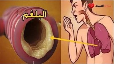 وصفات تطرد البلغم من صدرك