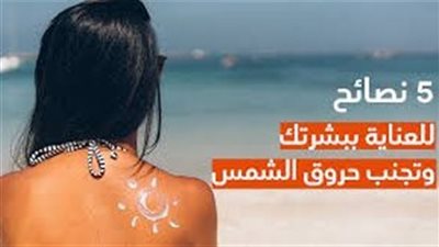  كيفية الوقاية والعلاج من حروق الشمس